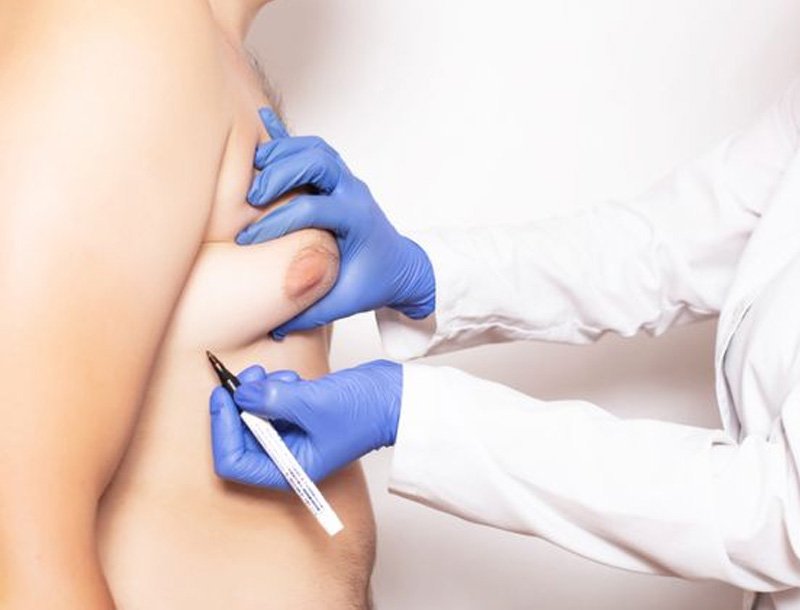 Specialized Procedures Designed for Natural and Long-Lasting Outcomes